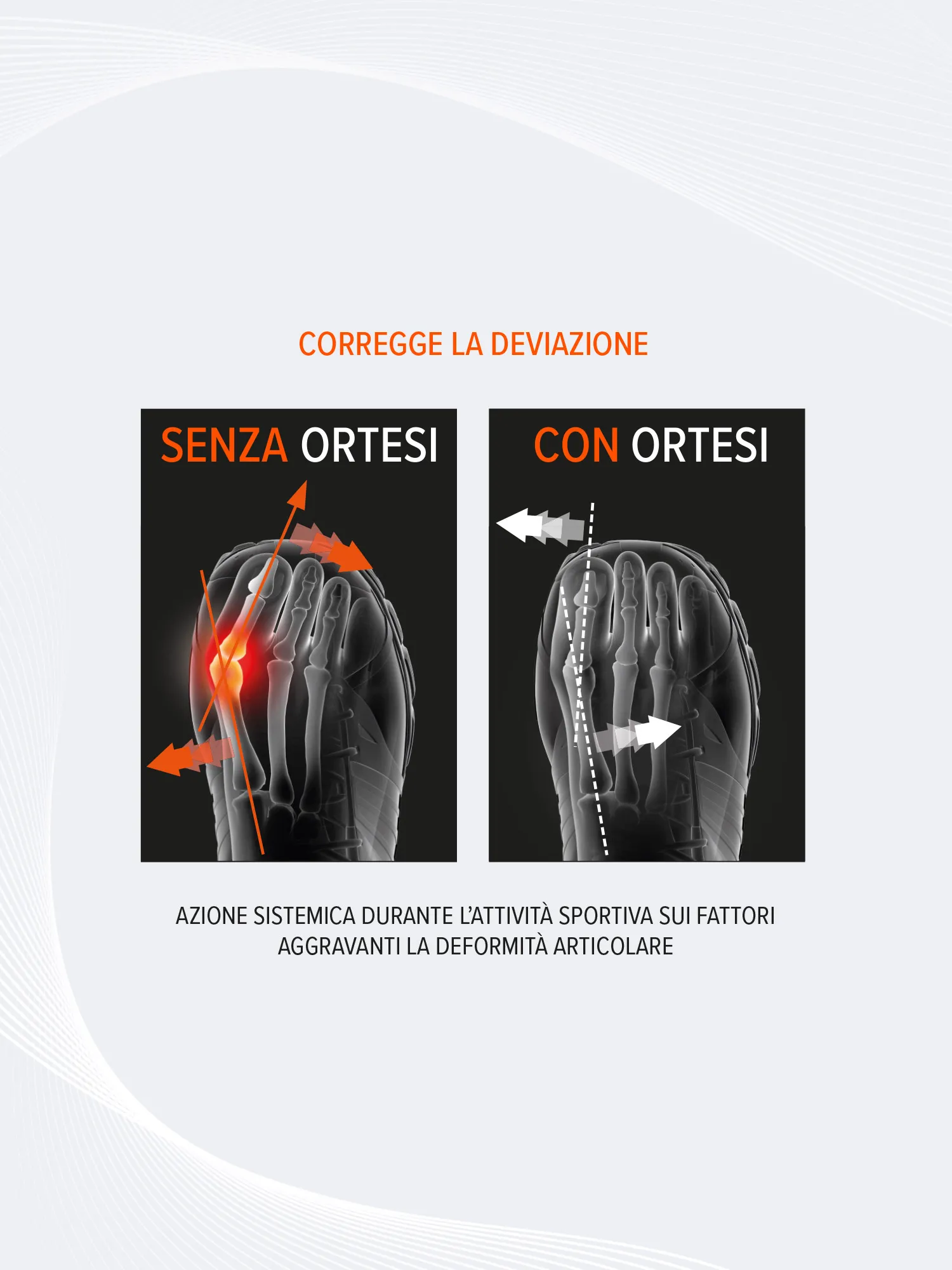 ORTESI CORRETTIVA ALLUCE VALGO SPORT